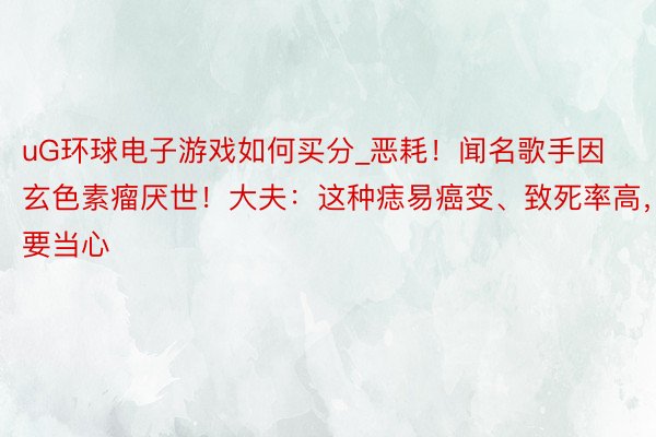 uG环球电子游戏如何买分_恶耗！闻名歌手因玄色素瘤厌世！大夫：这种痣易癌变、致死率高，要当心